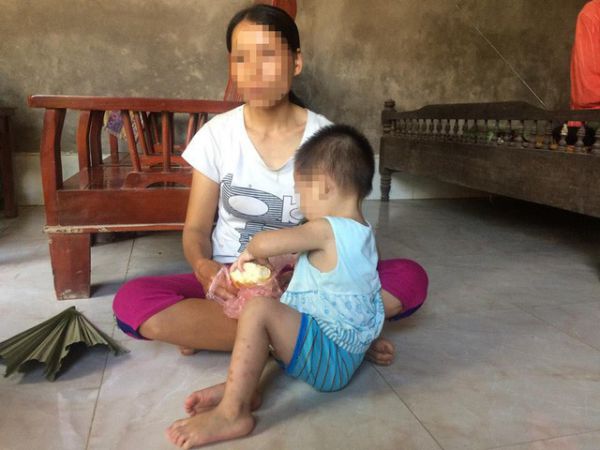 nguy cơ lây nhiễm HIV, Cục phòng chống HIV/AIDS, đường lây truyền, bệnh nhân HIV, 42 ca nhiễm HIV, dùng chung kim tiêm