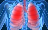 Các bệnh về phổi chữa như thế nào cho hiệu quả?