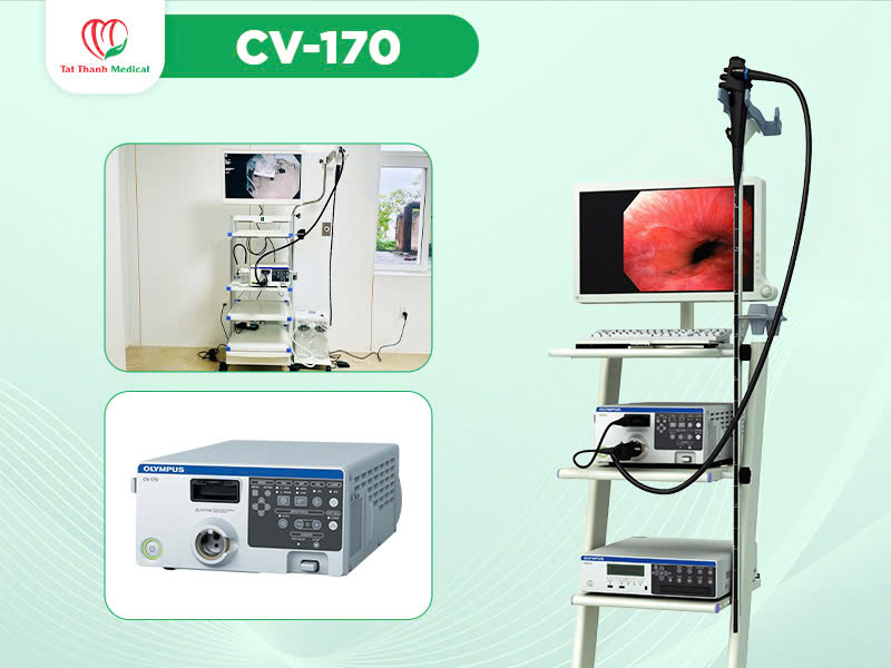 Olympus nâng tầm chuẩn chẩn đoán với hệ thống nội soi tiêu hóa CV-170, CV-190 và EVIS X1