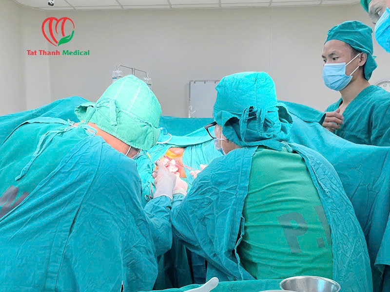 Đâu là máy điều trị trĩ bằng sóng cao tần an toàn và hiệu quả?
