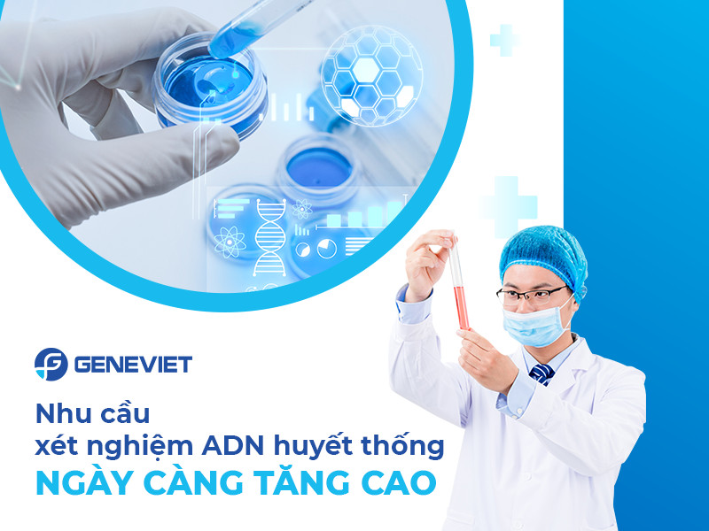 Giá xét nghiệm huyết thống